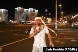Povrijeđeni demonstrant na ulicama Minska 10. avgusta. Snage sigurnosti koristile su šok bombe i gumene metke protiv demonstranata. Nekoliko njih bilo je pretučeno.